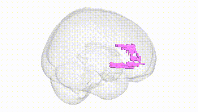 Full Brain White