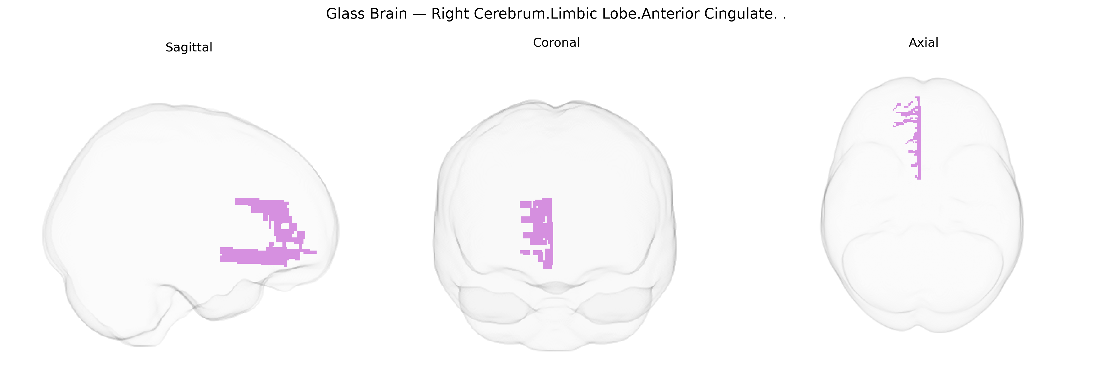 Triplanar Ghost Brain
