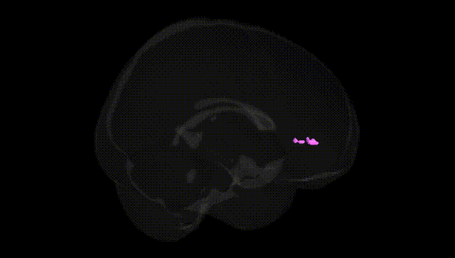 Full Brain Black