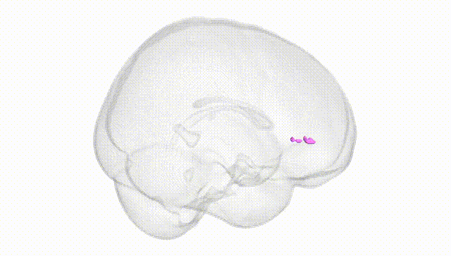Full Brain White