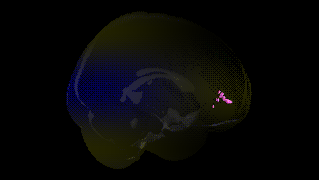 Full Brain Black