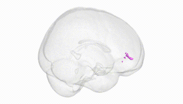 Full Brain White