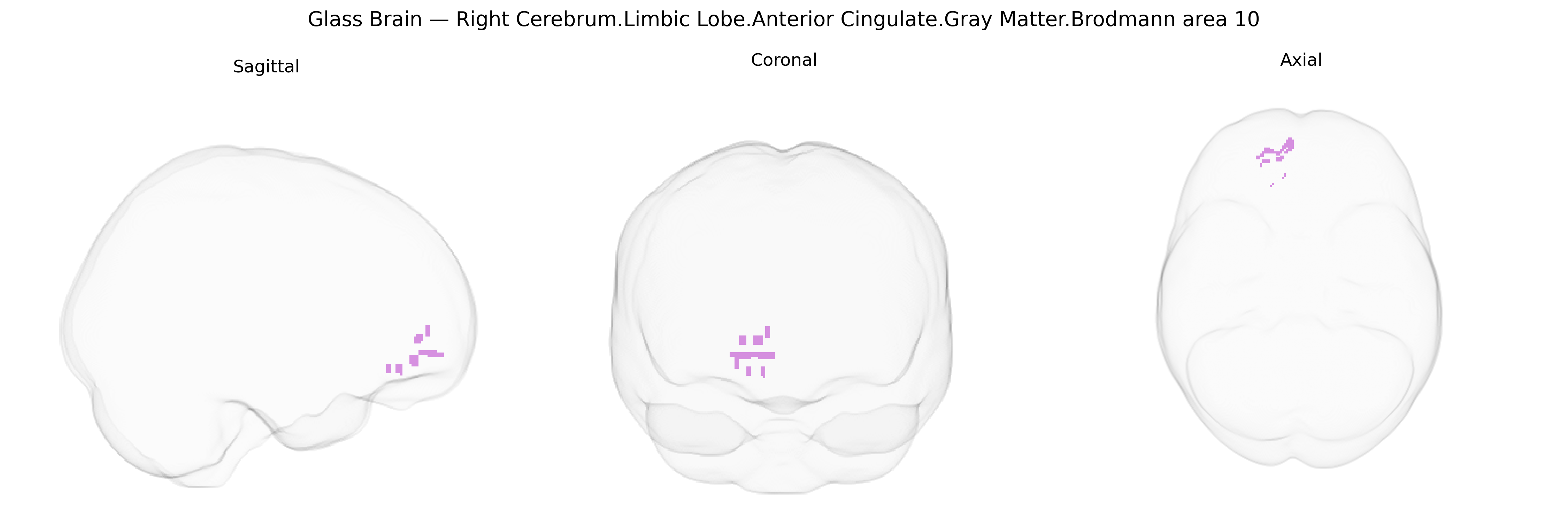 Triplanar Ghost Brain