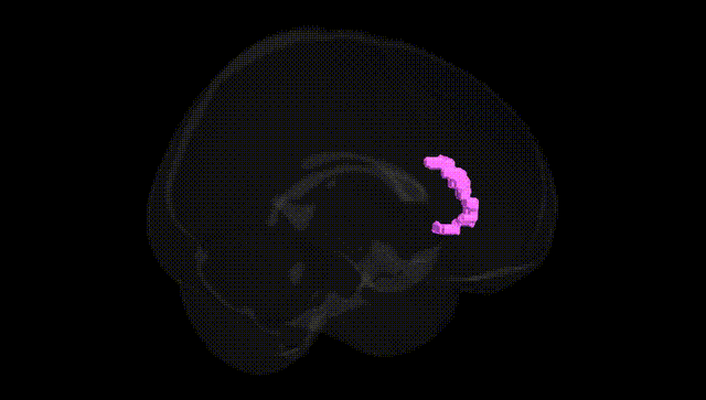 Full Brain Black