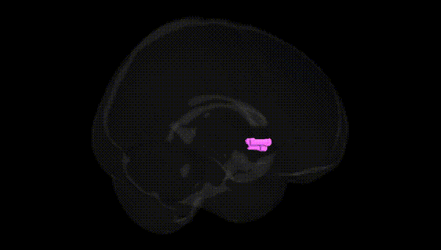 Full Brain Black