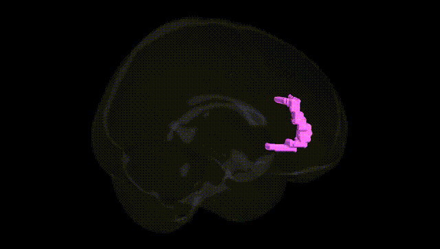 Full Brain Black