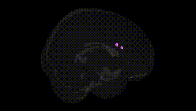 Full Brain Black