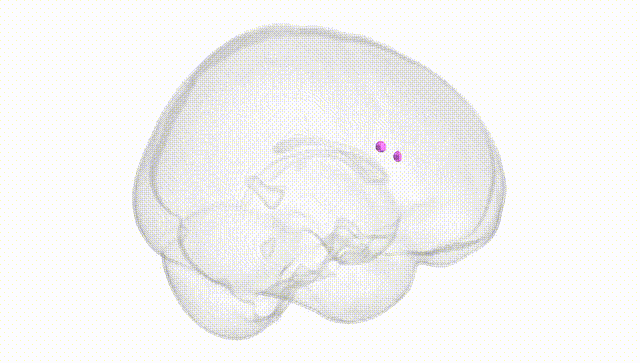 Full Brain White