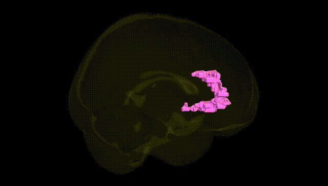 Full Brain Black