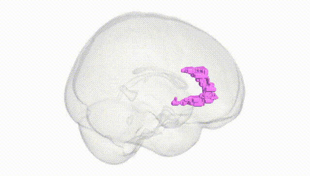 Full Brain White
