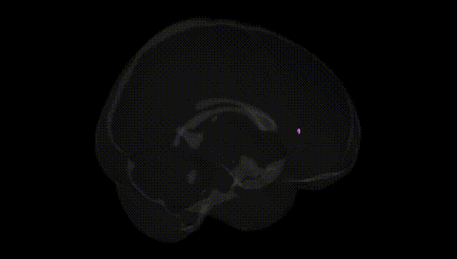 Full Brain Black