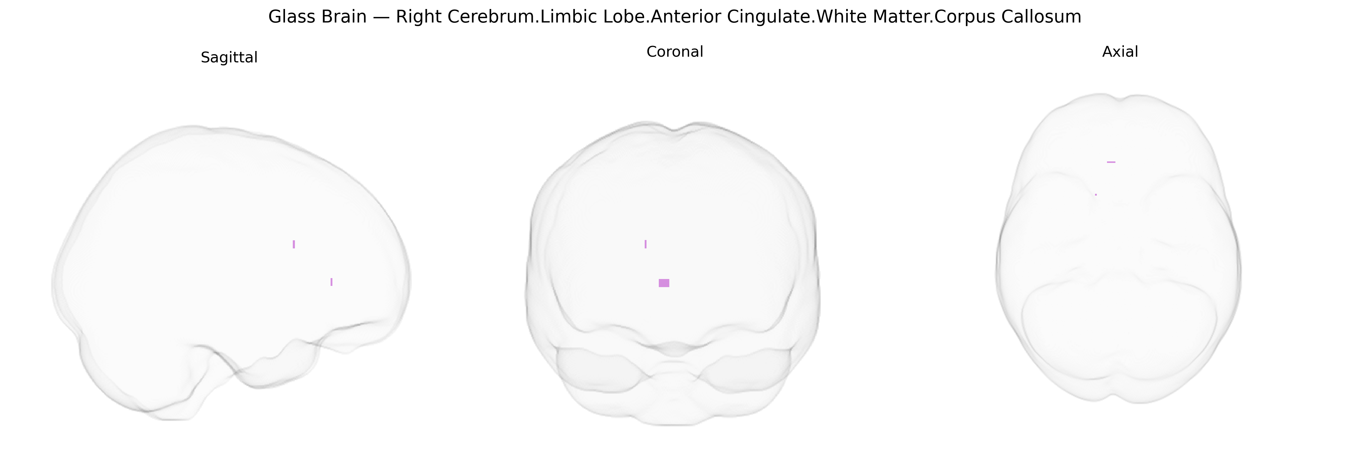 Triplanar Ghost Brain