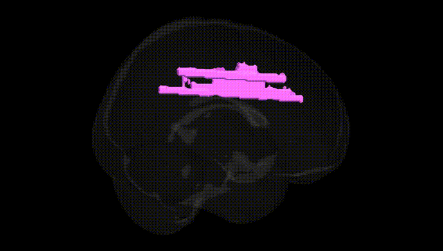 Full Brain Black