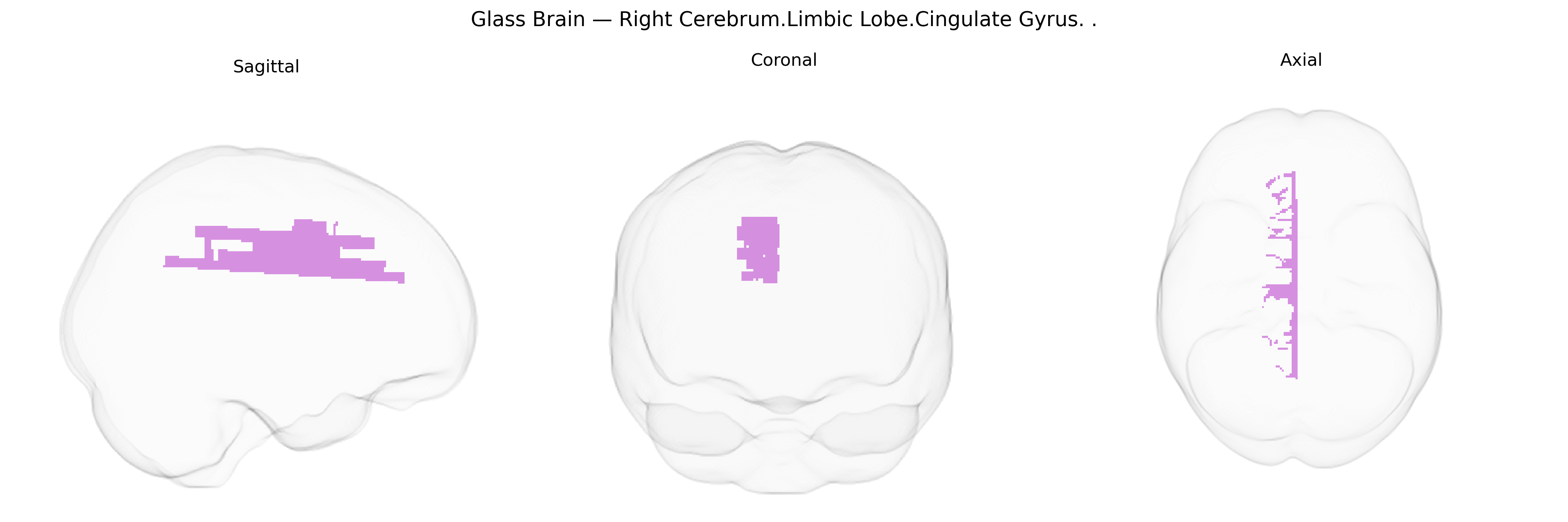 Triplanar Ghost Brain