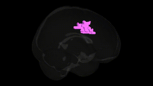 Full Brain Black