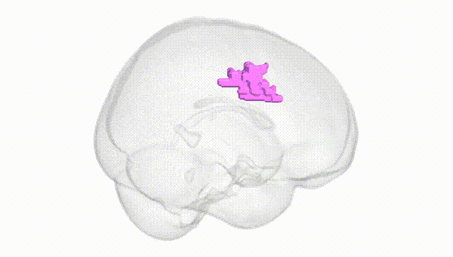 Full Brain White