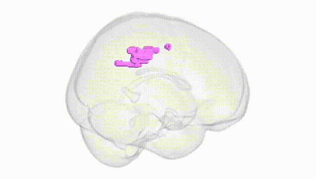 Full Brain White
