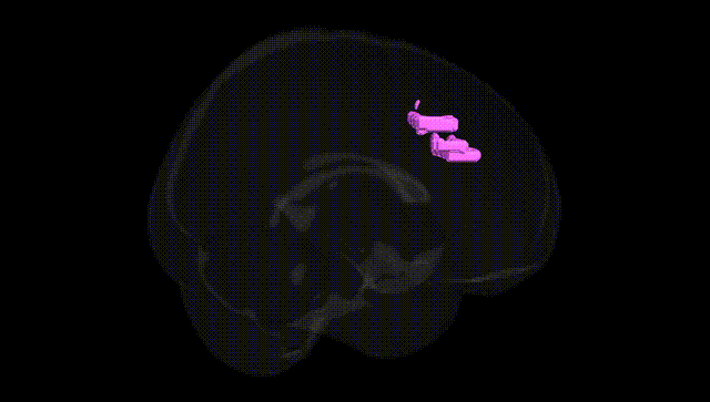 Full Brain Black