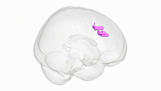 Full Brain White