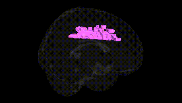 Full Brain Black