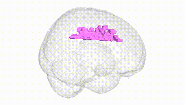 Full Brain White