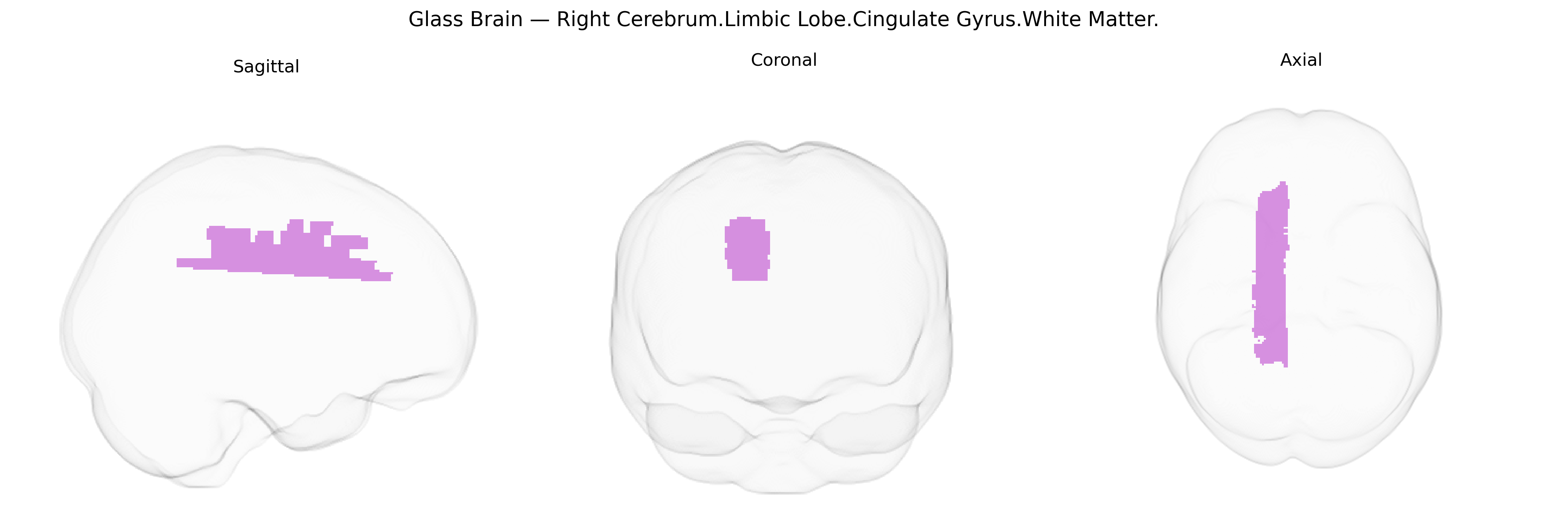 Triplanar Ghost Brain