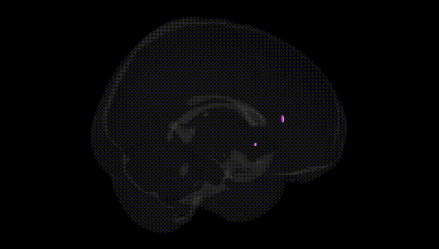 Full Brain Black