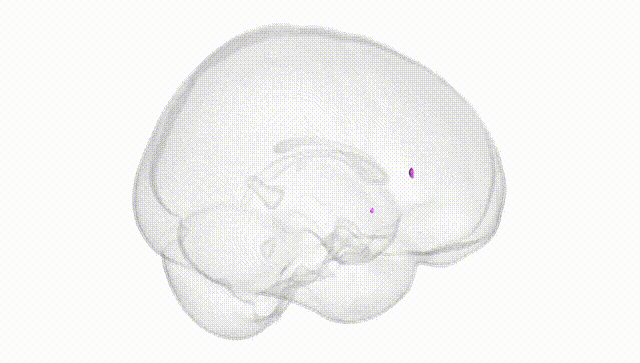Full Brain White