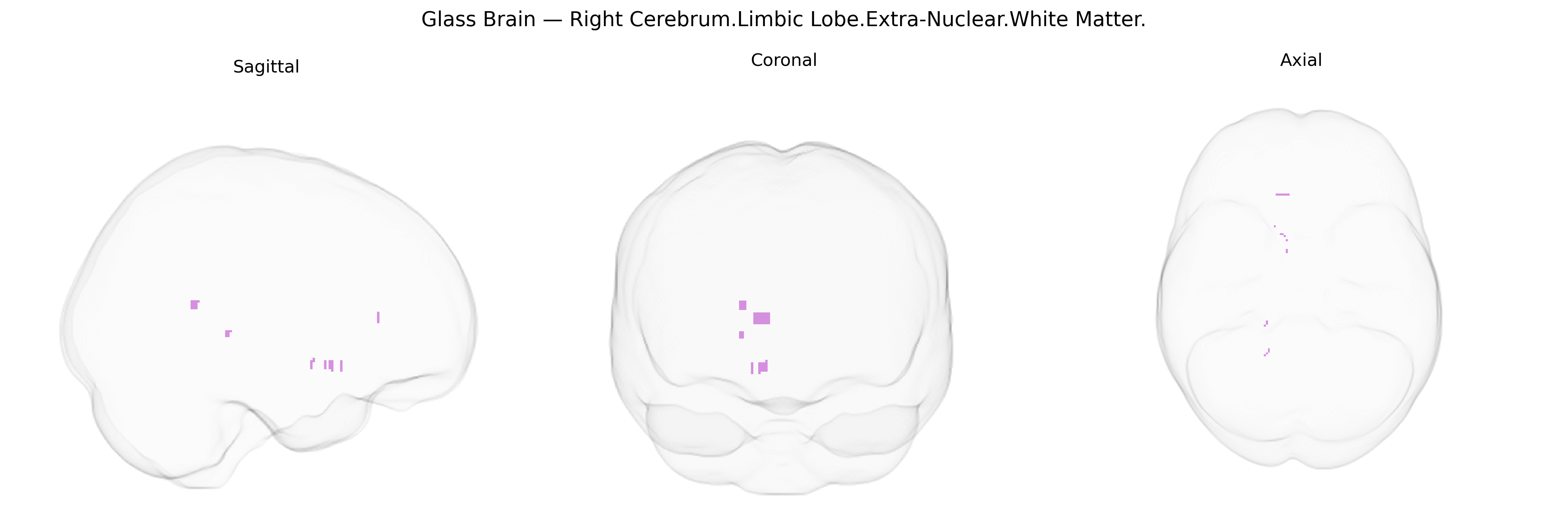 Triplanar Ghost Brain