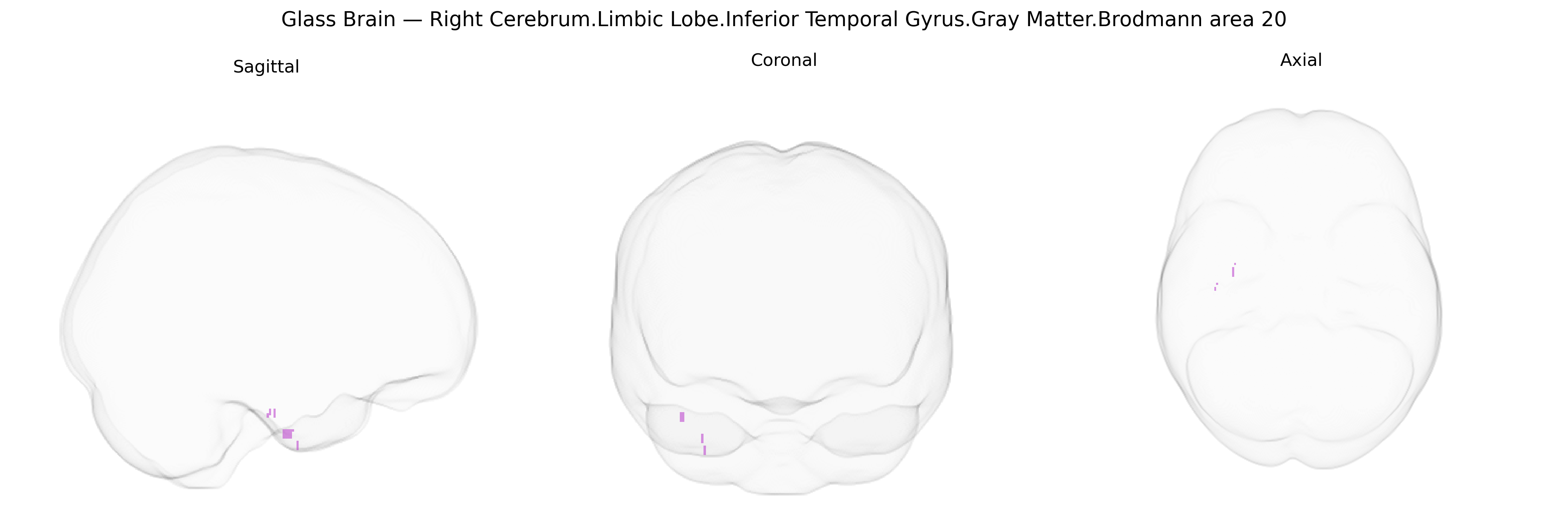 Triplanar Ghost Brain