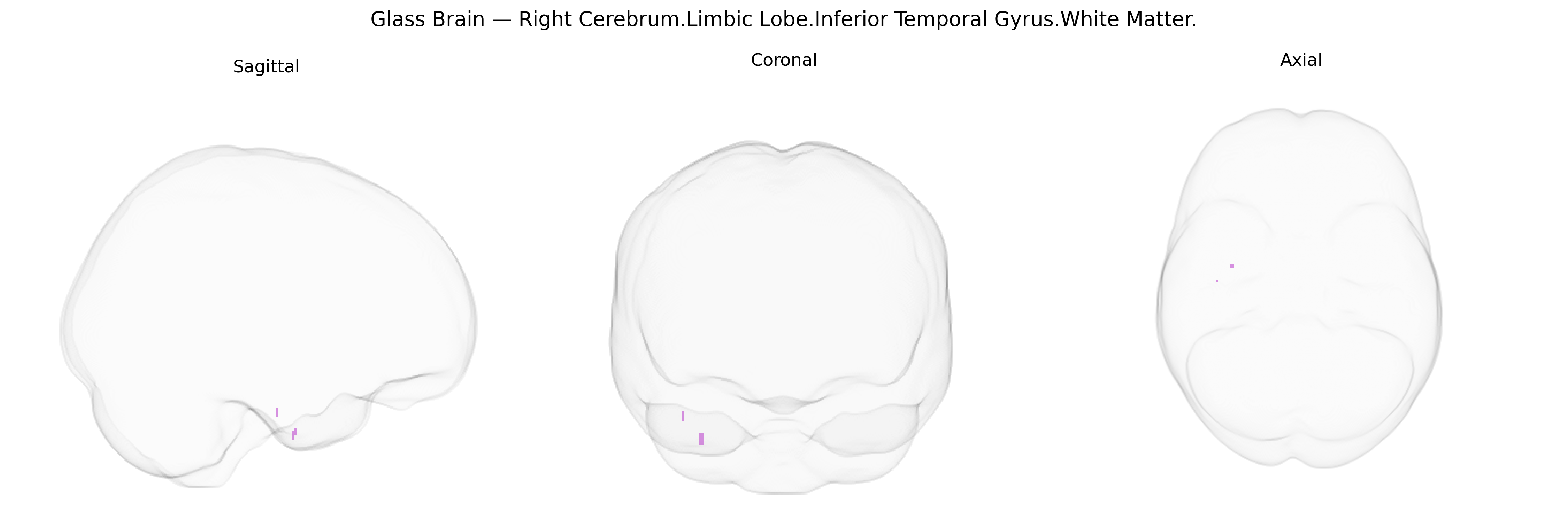 Triplanar Ghost Brain