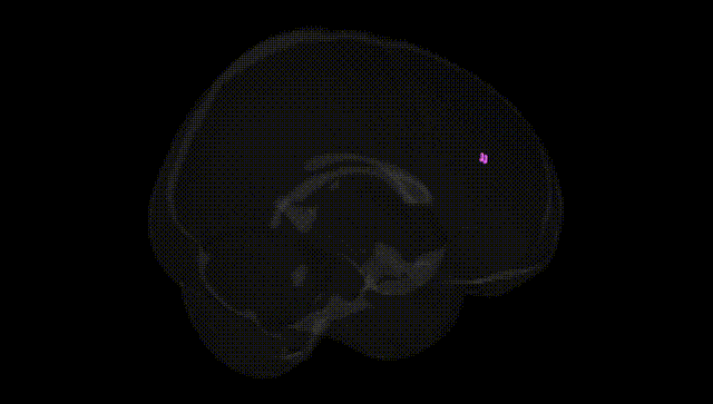 Full Brain Black