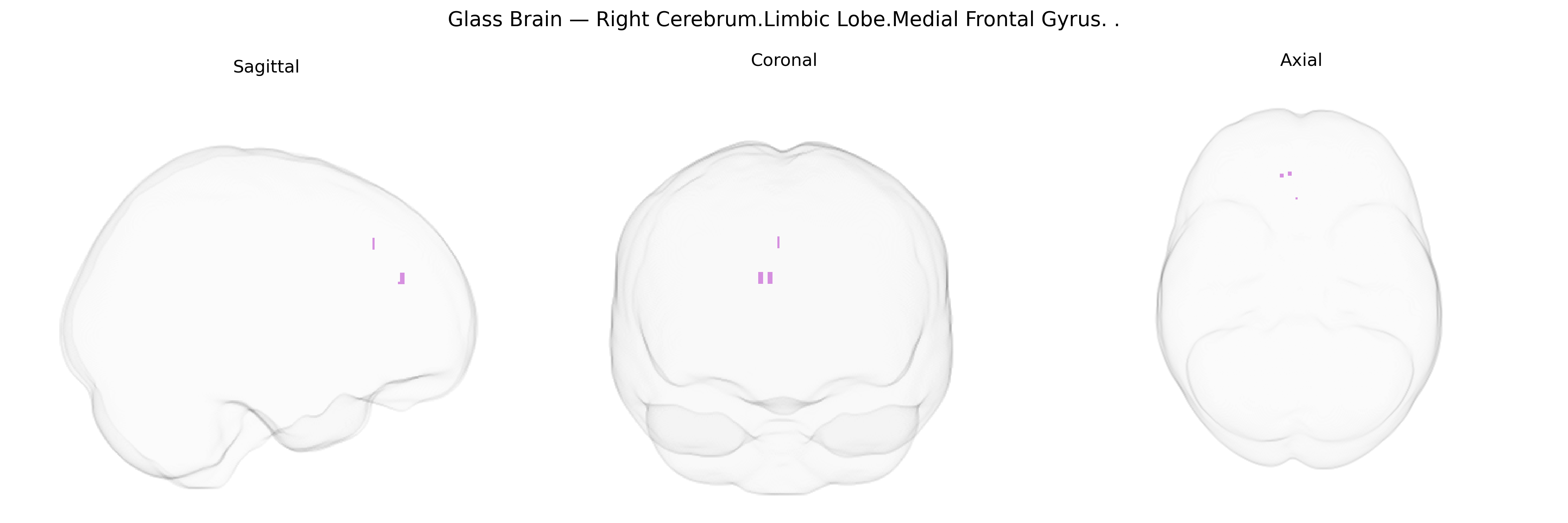 Triplanar Ghost Brain