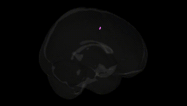 Full Brain Black
