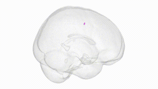 Full Brain White