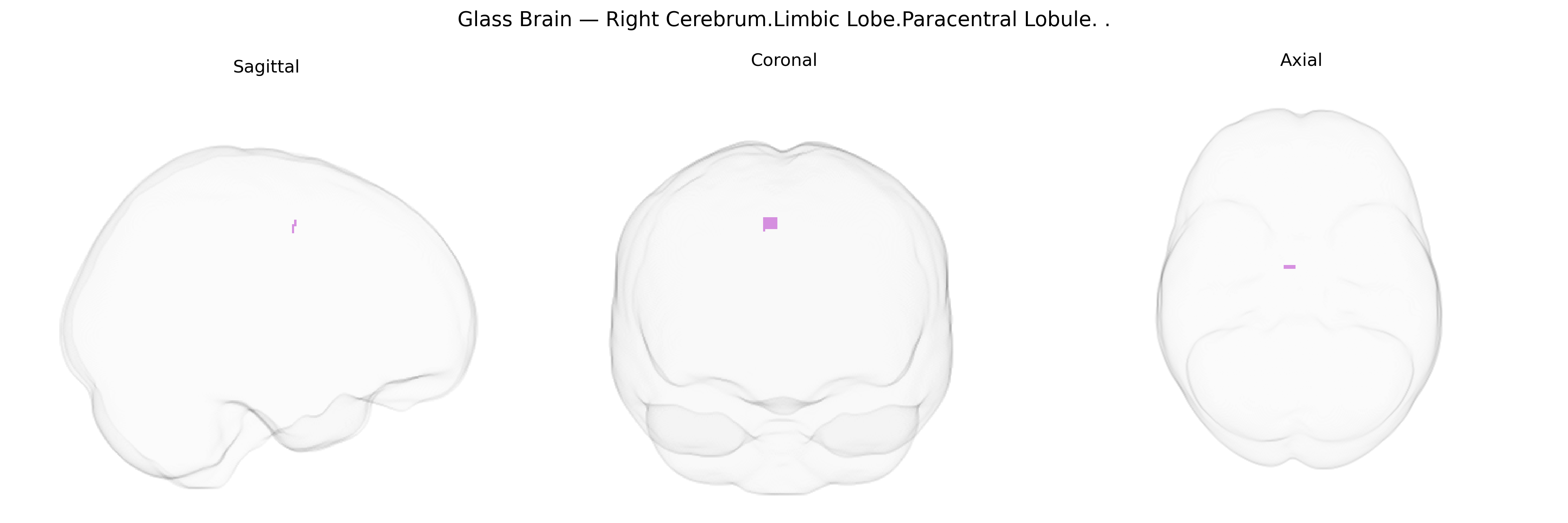 Triplanar Ghost Brain