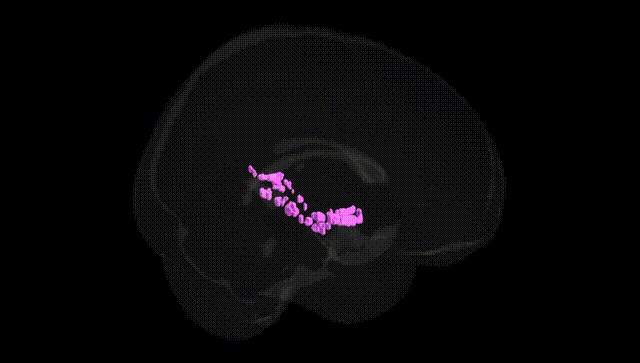 Full Brain Black