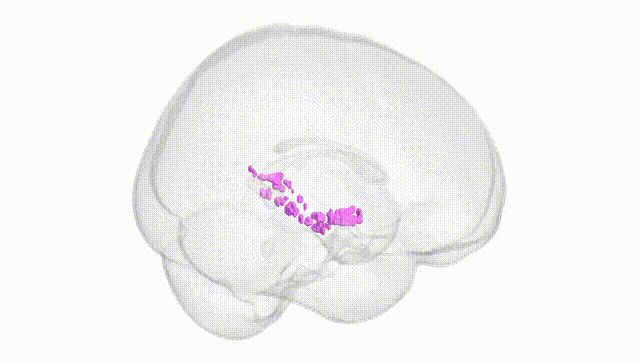 Full Brain White