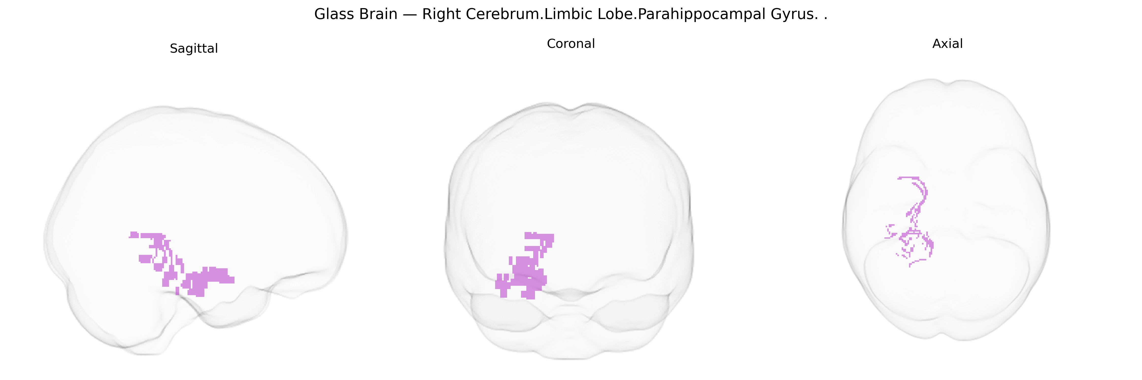 Triplanar Ghost Brain