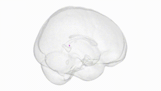 Full Brain White