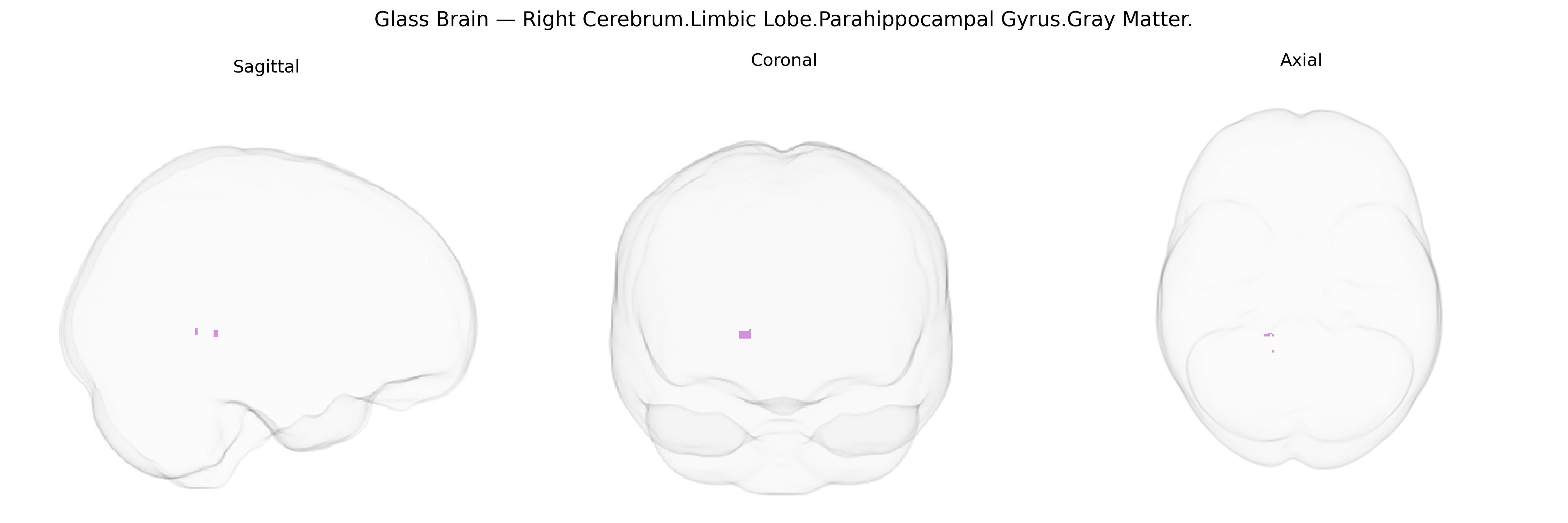 Triplanar Ghost Brain