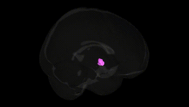 Full Brain Black