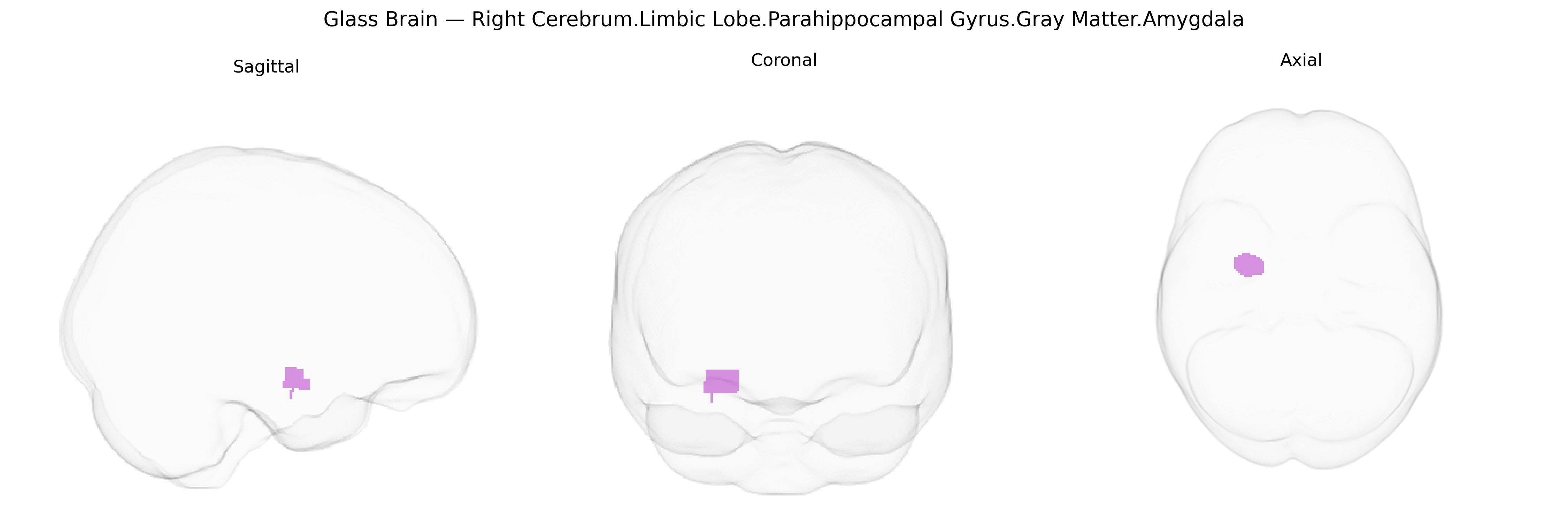 Triplanar Ghost Brain