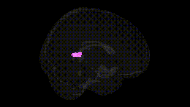 Full Brain Black