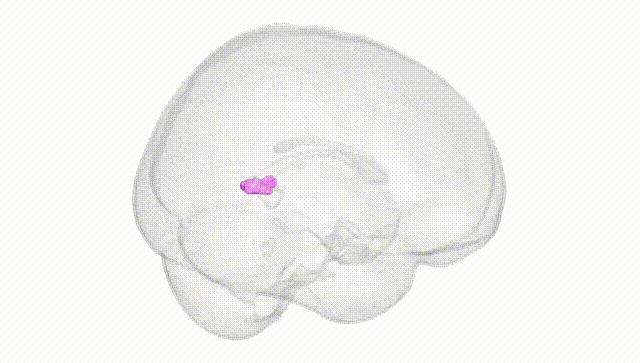 Full Brain White