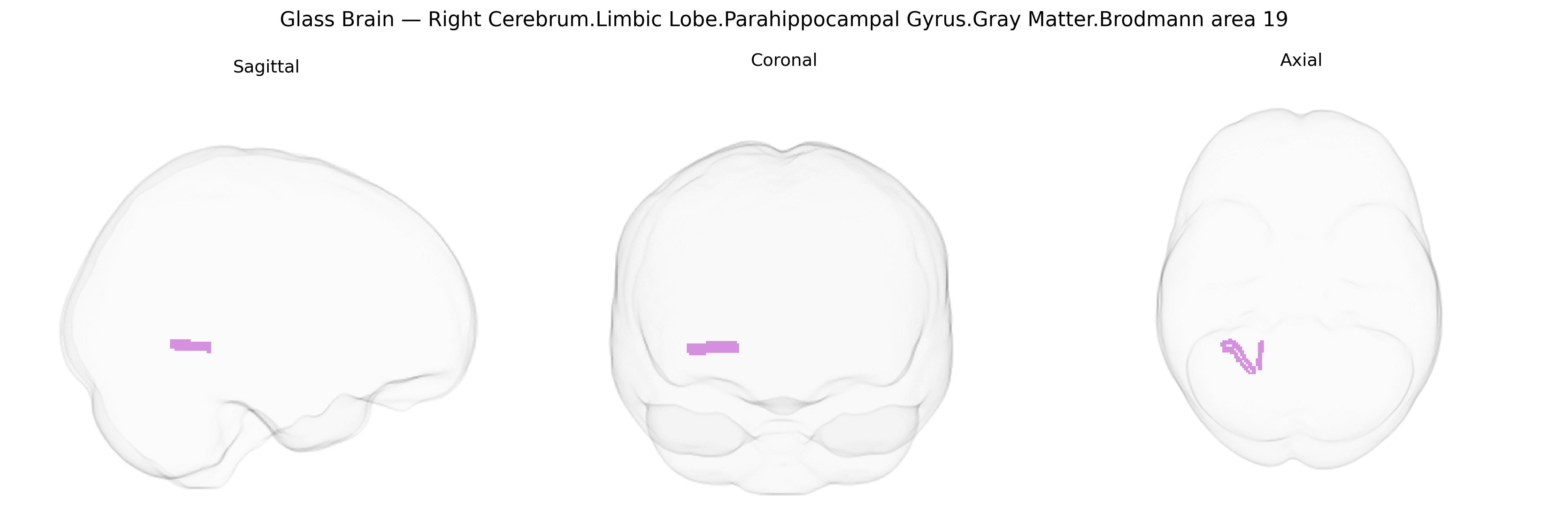 Triplanar Ghost Brain
