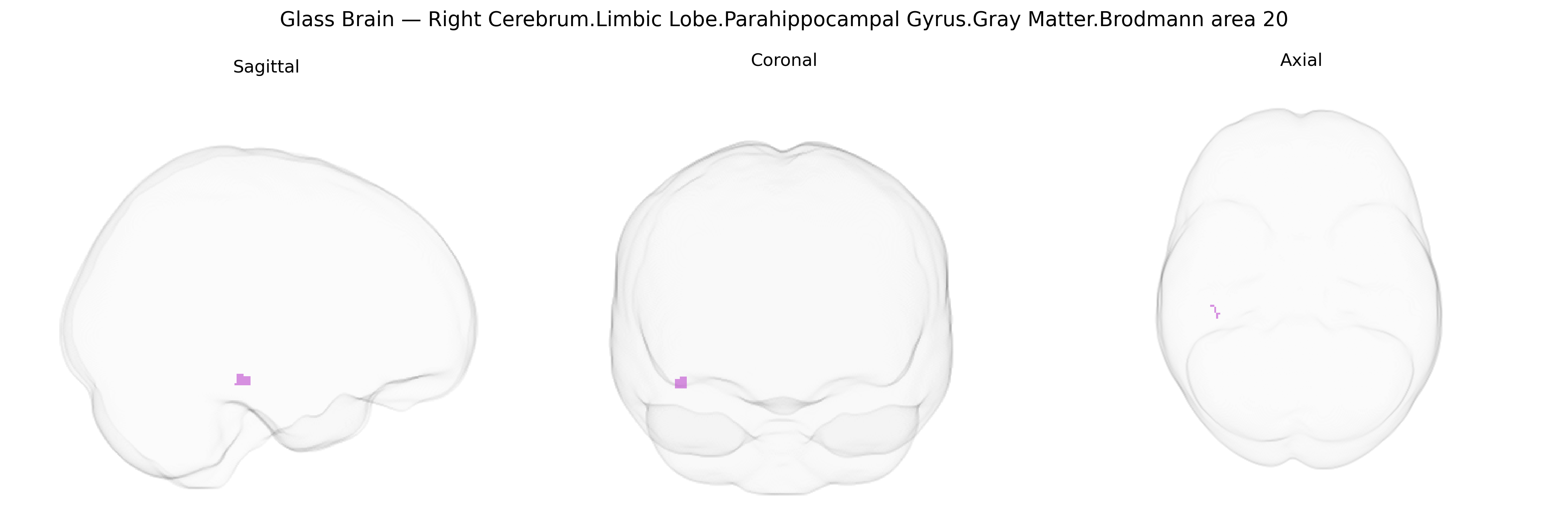 Triplanar Ghost Brain