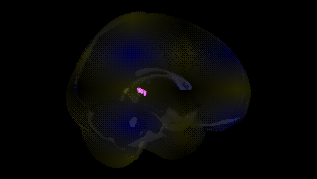 Full Brain Black