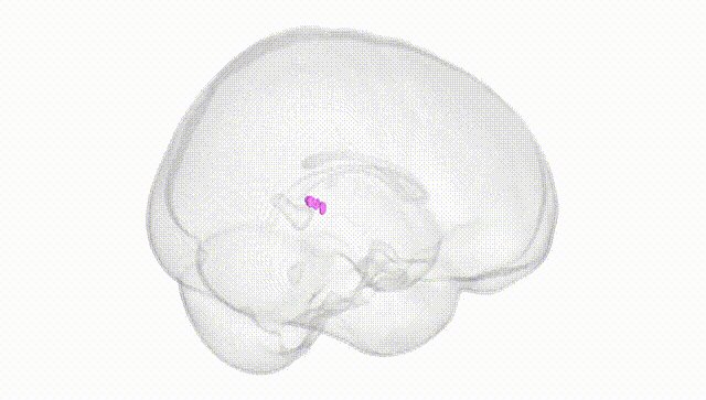 Full Brain White