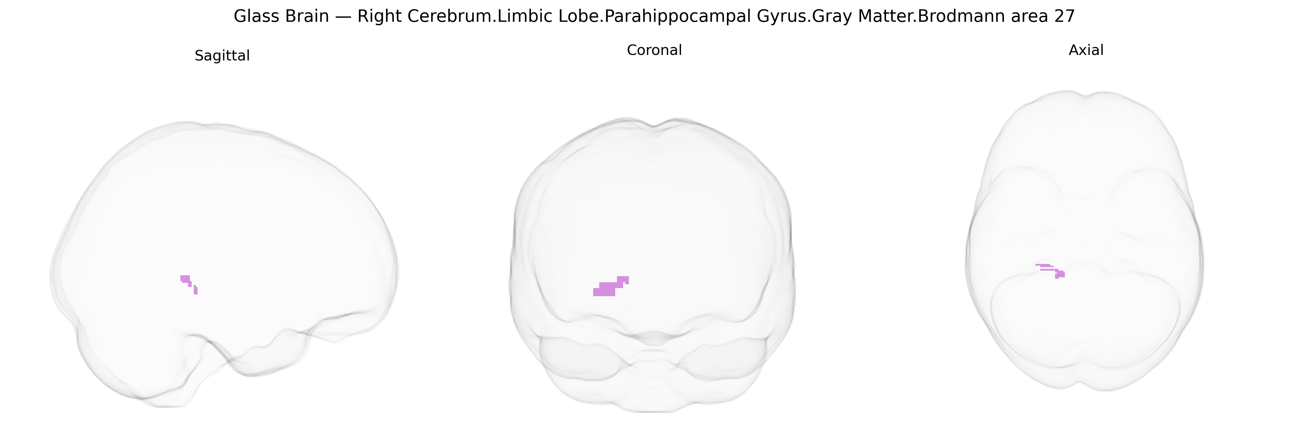 Triplanar Ghost Brain